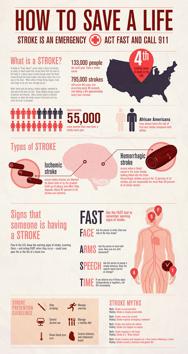 Informational infographic about strokes